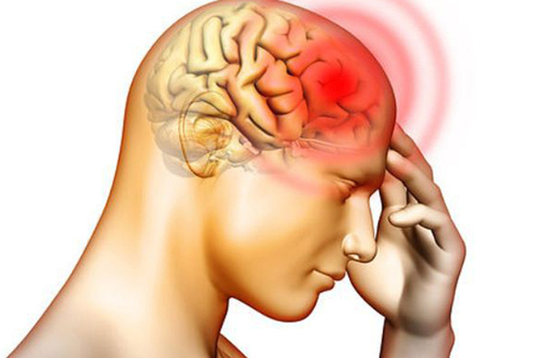 Người đàn ông 28 tuổi đột quỵ sau cơn đau đầu-2