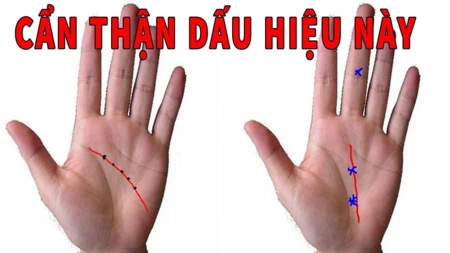 Người sở hữu tướng bàn tay tán lộc: Cả đời nghèo khổ, quần quật vẫn không thoát nghèo-1