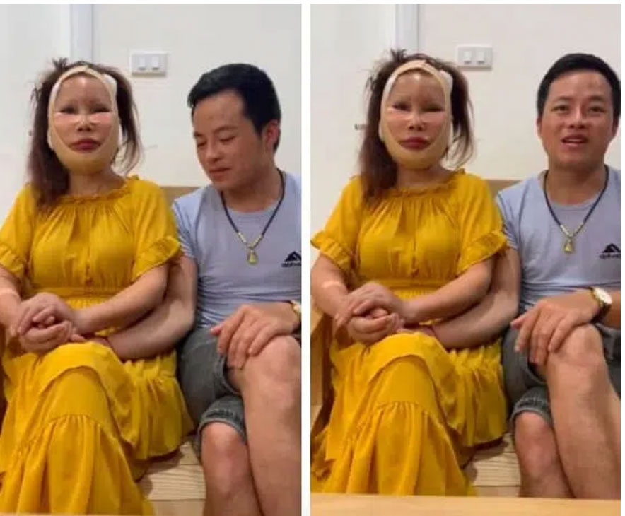 Cô dâu 63 tuổi tiếp tục xuất hiện trong livestream với khuôn mặt méo lệch, nhăn nhó sau đại phẫu căng da mặt hàng chục triệu khiến dân mạng hốt hoảng-1