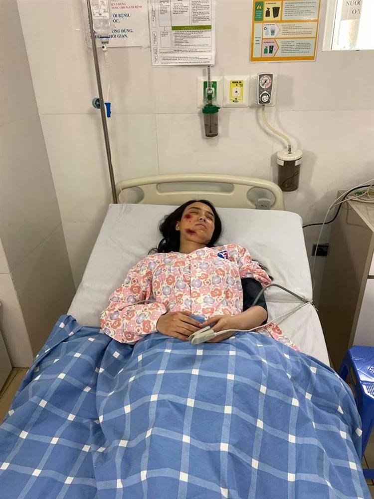 Hé lộ thêm loạt ảnh Linh Miu bị đánh bầm dập, nằm bất động trên giường bệnh-1