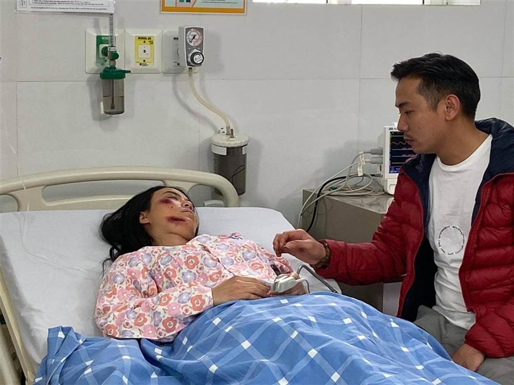 Hé lộ thêm loạt ảnh Linh Miu bị đánh bầm dập, nằm bất động trên giường bệnh-2