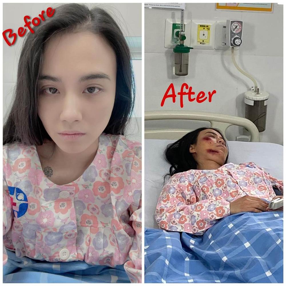 Hé lộ thêm loạt ảnh Linh Miu bị đánh bầm dập, nằm bất động trên giường bệnh-3