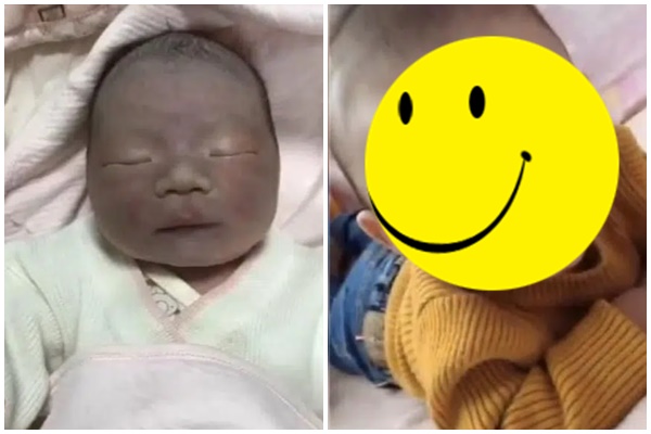 Đứa trẻ sinh ra mặt đen như Bao Công, mẹ chồng mắng con dâu do ăn nhiều dâu tằm, 2 tháng sau bé thay đổi gây sốc-5