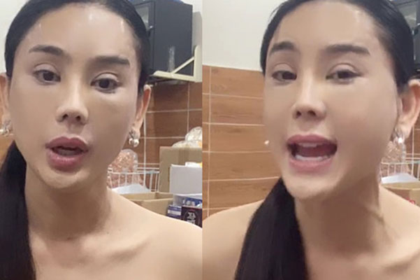 Lâm Khánh Chi lộ vùng cổ nhăn nheo, chi chít nốt sần khiến ai nấy rùng mình-6