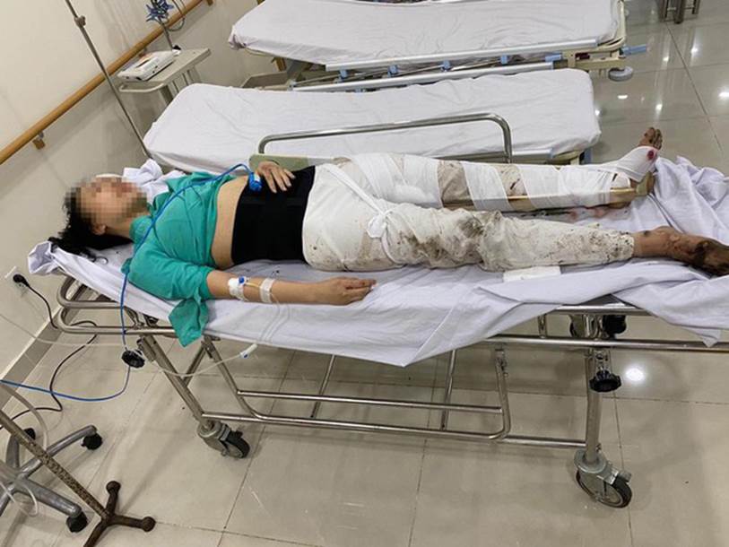 Hình ảnh nữ tiếp viên hàng không Vietnam Airlines chống nạng đến tòa với đôi chân chi chít vết thương khiến nhiều người xúc động-1