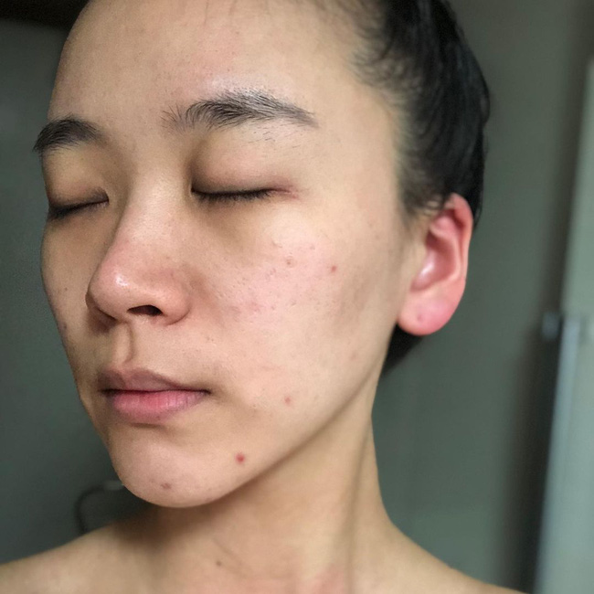 5 dấu hiệu cho thấy bạn đã chọn đồ skincare sai bét, không ngưng dùng ngay thì da càng xấu không lối thoát-3