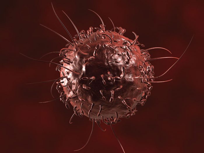 Bỗng dưng thấy 3 dấu hiệu này ở chân, bạn cần đi khám ung thư gan, xương ngay lập tức!-1