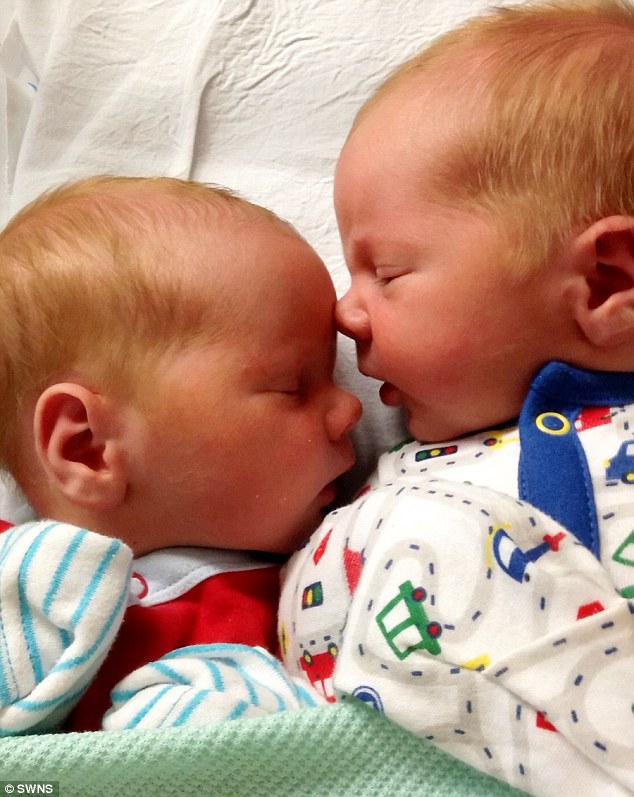 Siêu âm bác sĩ cho biết cặp song sinh phát triển tốt, nhưng đến lúc đỡ đẻ thì ai nấy ngã ngửa khi nhìn cơ thể mỗi bé-1