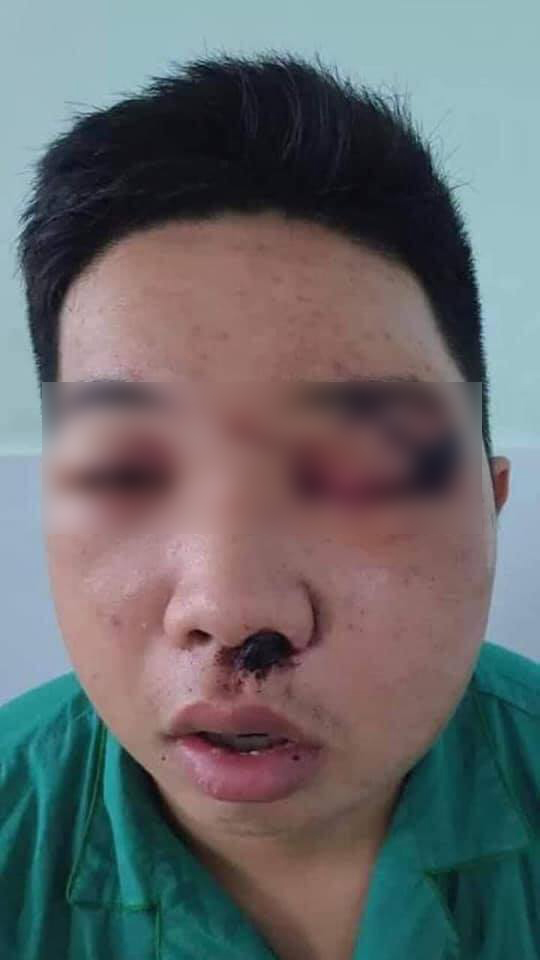 Xôn xao hình ảnh thanh niên cố tình xúc phạm nghệ sĩ Chí Tài bị đánh sưng húp mặt mũi-1