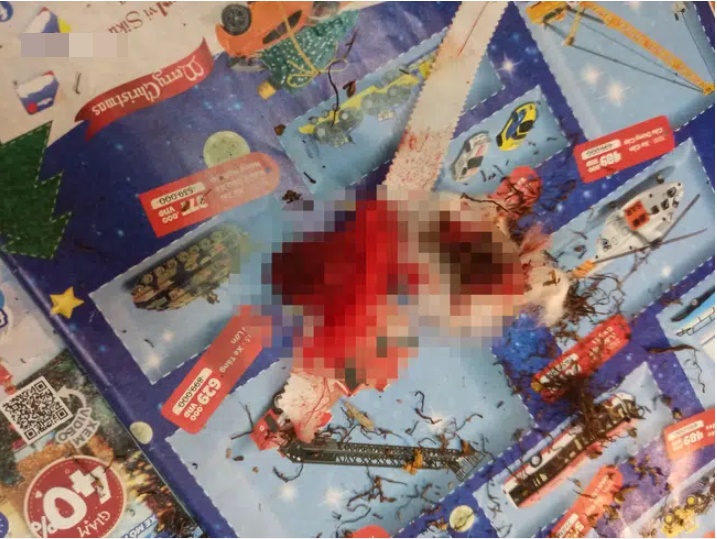 Con trai đi vệ sinh xong tay đầm đìa máu, mẹ Hà Nội tá hỏa bế đi viện gấp, nguyên nhân hóa ra do đồ vật các ông bố hay sử dụng-1