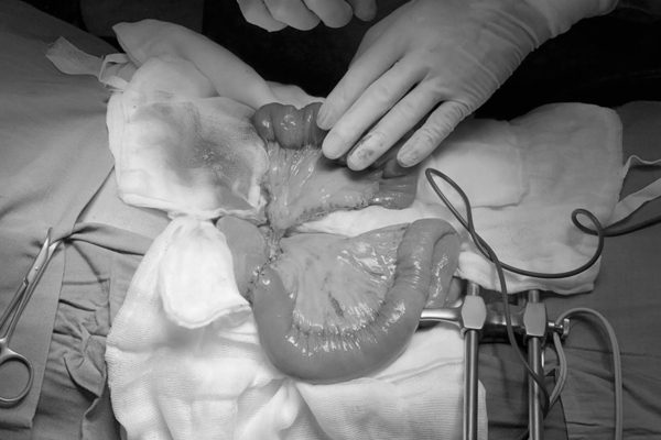 Ho đờm 1 tháng, người đàn ông Hưng Yên phát hiện ung thư giai đoạn cuối-2