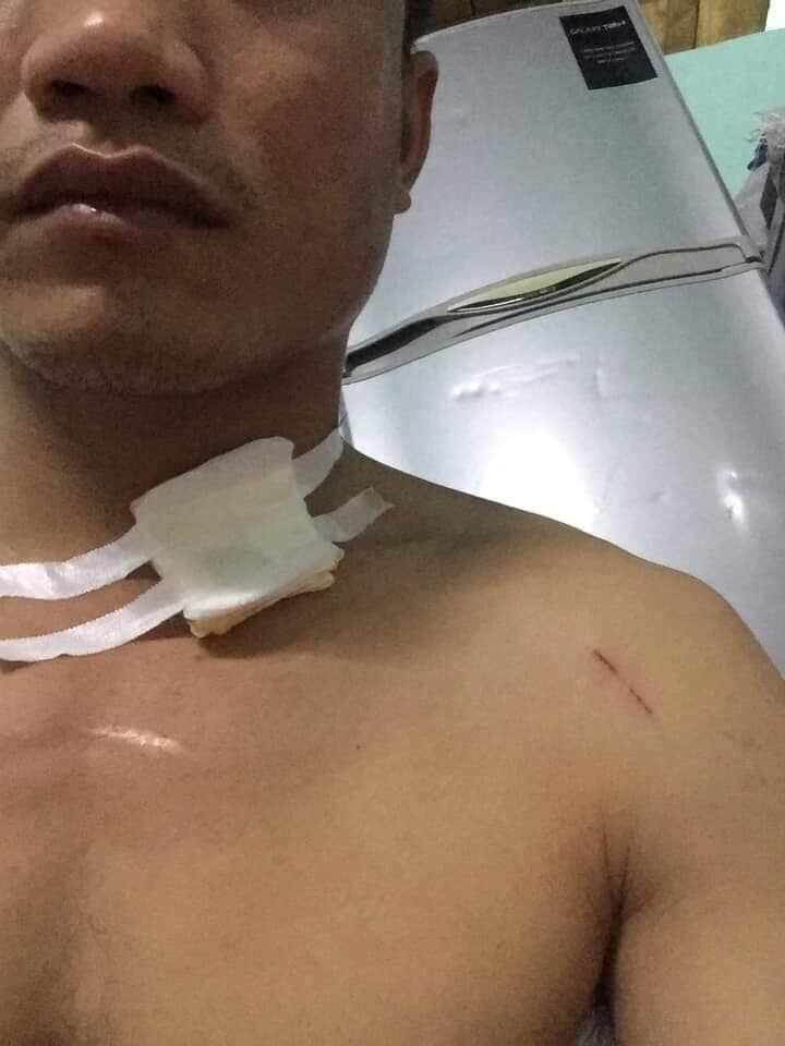 Lời kể của tài xế xe ôm bị khách kề dao đâm vào cổ cướp sạch tài sản trong đêm-3