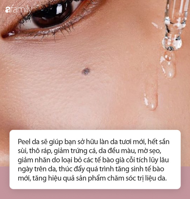 Muốn peel da để làm đẹp cuối năm, chị em cần nắm rõ 3 nguyên tắc, mọi người càng không nên peel da tại nhà-2