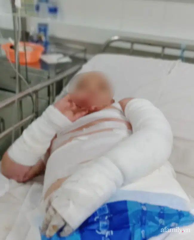 Vụ cha đóng cửa nhà châm lửa đốt khiến 2 con bỏng nặng, bản thân tử vong tại TP.HCM: Người mẹ bị sốc tâm lý, lúc tỉnh lúc mê-2