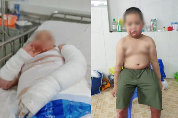 Giận vợ, người đàn ông châm lửa thiêu rụi chiếc ô tô-4