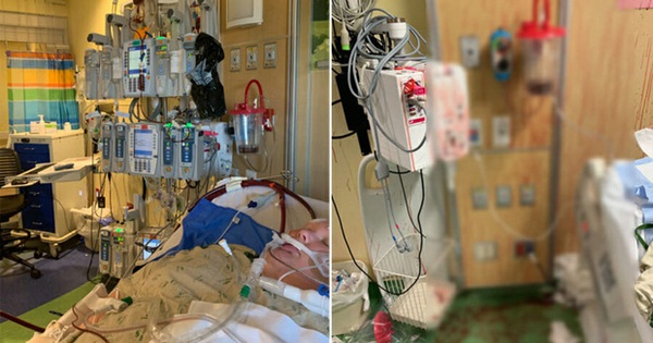 Bức hình ám ảnh: Bà mẹ đau đớn chia sẻ hình ảnh con trai ho ra máu, nhuộm đỏ tường trước khi lìa đời vì nhiễm Covid-19-1