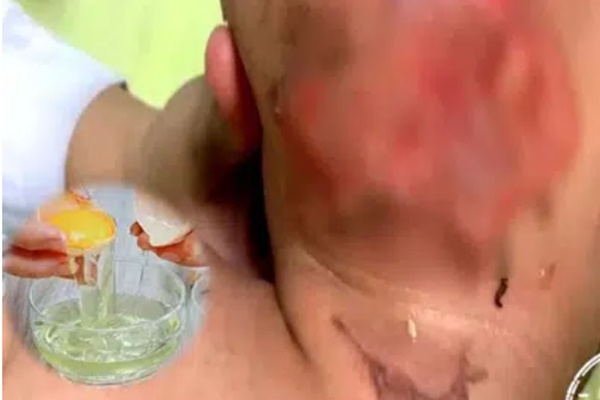 Bé gái vô tình nuốt phải gói hút ẩm, cách xử lý của bà nội được bác sĩ khen ngợi, bố mẹ nên học hỏi để sơ cứu trong tình huống khẩn cấp-4