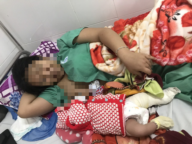 Bệnh viện Đa khoa Quảng Nam báo cáo việc bé trai gãy chân khi sinh mổ-2