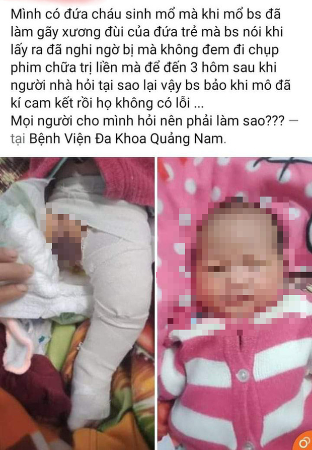 Bệnh viện Đa khoa Quảng Nam báo cáo việc bé trai gãy chân khi sinh mổ-3