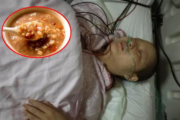 Ung thư không khủng khiếp, điều khủng khiếp là tế bào ung thư sẽ di căn, cơ thể xuất hiện 4 hiện tượng này, hãy đi khám ngay lập tức-4