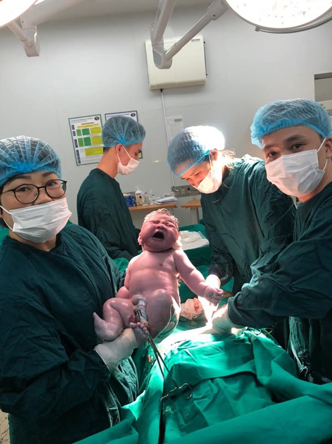 Bé trai gần 6kg chào đời tại BV Bệnh Nhiệt đới Trung ương-1