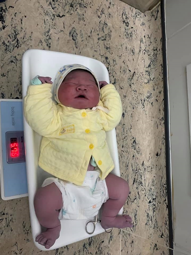 Bé trai gần 6kg chào đời tại BV Bệnh Nhiệt đới Trung ương-2