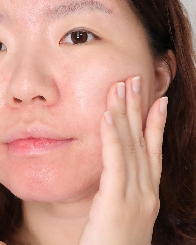 Chuyên gia cảnh báo: Chị em da yếu phải tránh 4 sản phẩm này thì mới thoát kiếp da xấu-3