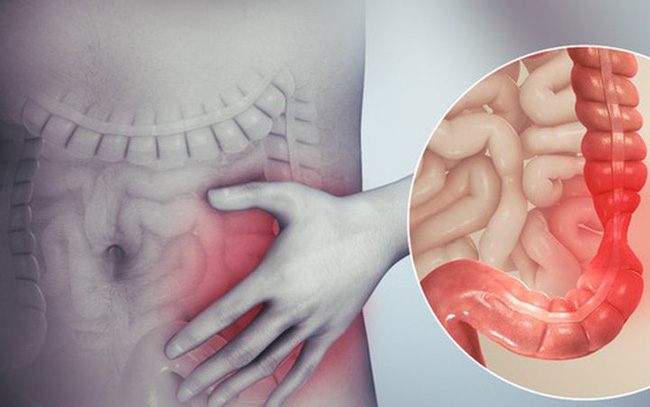 Chuyên gia cảnh báo 9 cách giải độc vừa gây hại cơ thể vừa tốn tiền-1