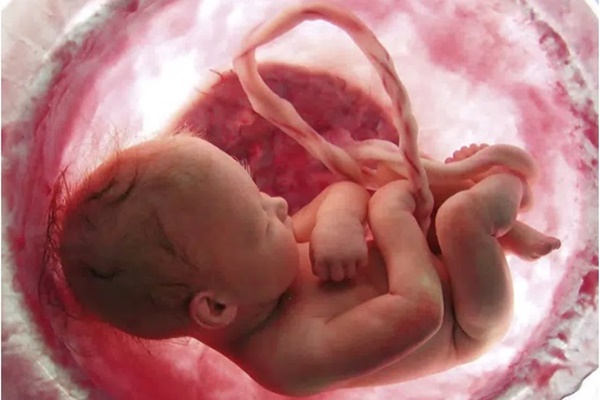 Lần đầu phát hiện hạt vi nhựa trong máu người-1