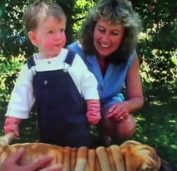 Chào đời với làn da nhăn nheo như một ông già, bé trai khiến bố mẹ sốc nặng, nhiều năm sau ai cũng choáng khi nhìn thấy hình hài đứa trẻ-4