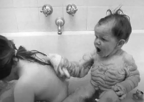 Chào đời với làn da nhăn nheo như một ông già, bé trai khiến bố mẹ sốc nặng, nhiều năm sau ai cũng choáng khi nhìn thấy hình hài đứa trẻ-7