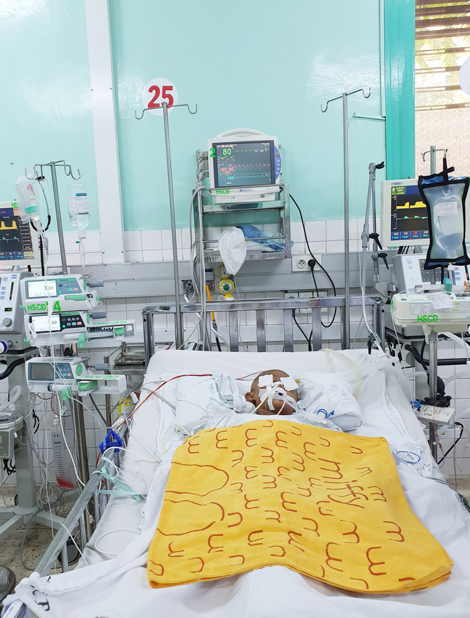 Vụ bé trai 4 tuổi nghi bị dượng say xỉn dùng kéo đâm xuyên mắt, chấn thương não: Đang thở máy, tiên lượng rất nặng-2