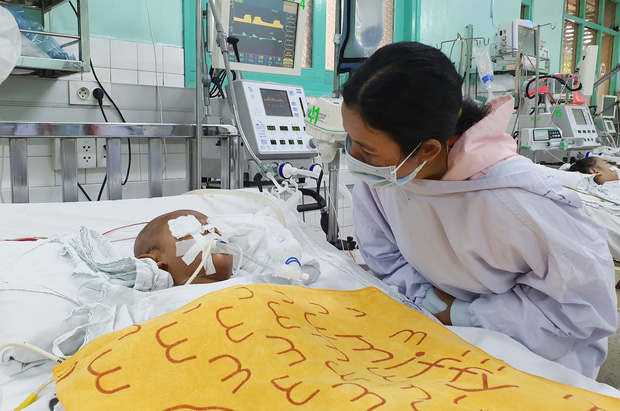 Vụ bé trai 4 tuổi nghi bị dượng say xỉn dùng kéo đâm xuyên mắt, chấn thương não: Đang thở máy, tiên lượng rất nặng-8