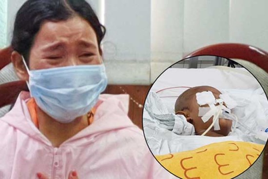 Người mẹ có con trai 4 tuổi bị đâm xuyên mắt, xuất huyết não: