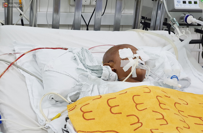 Người mẹ có con trai 4 tuổi bị đâm xuyên mắt, xuất huyết não: Cha mới chết 4 tháng, giờ con làm sao em không sống nổi-2