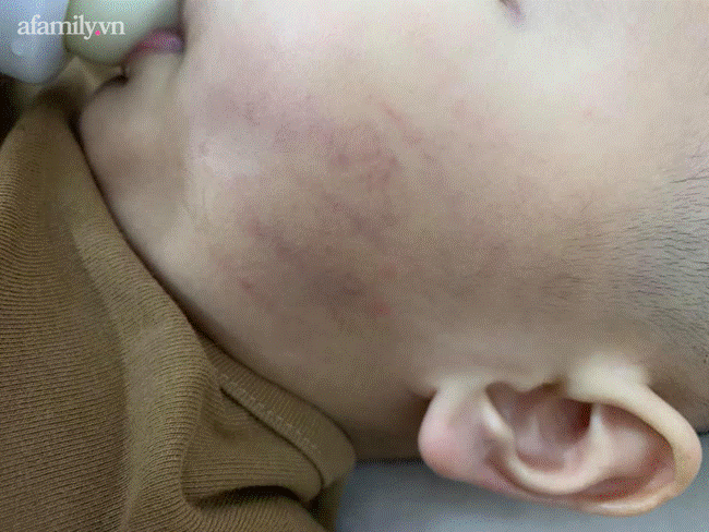 Nhìn lại những vụ giáo viên đánh tát đến cắn, nhốt trẻ mầm non gây chấn động năm 2020: Người bị nghỉ việc lập tức, người cầu xin tha thứ-4