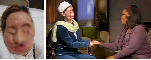 Đi làm giúp việc nhà người quen, người phụ nữ bị tinh tinh cào mặt đến mức không thể nhận ra, nhiều năm sau dung mạo của cô thay đổi kinh ngạc-3