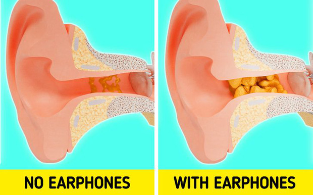 Điều gì sẽ xảy ra với cơ thể nếu bạn đeo tai nghe quá lâu?-3