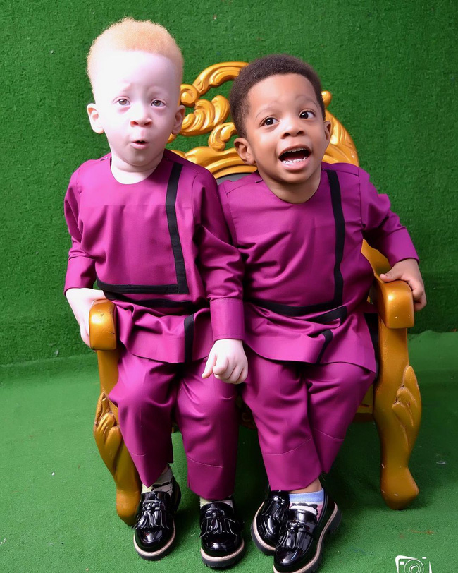 Vừa sinh con xong, mẹ ngơ ngác thấy các y tá đổ xô vào xem em bé, còn chồng thì đứng sững không thốt ra lời-13