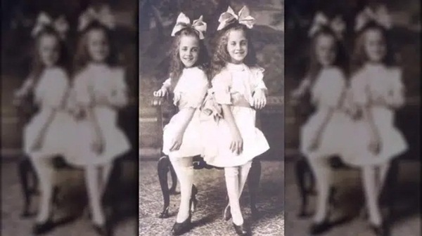 Cuộc đời chị em song sinh dính liền: Bị mẹ ruột ruồng bỏ, mưu sinh bằng cách phơi bày thân thể và những chuỗi ngày bi kịch nối tiếp bi kịch-1