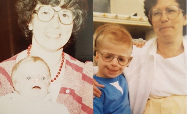 Cậu bé mặt chim” sinh ra mới chưa đầy 2 ngày đã bị bố mẹ bỏ rơi vì quá xấu xí gây bất ngờ với cuộc sống hiện tại bên bạn đời xinh đẹp-2