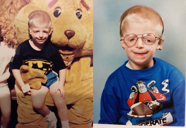 Cậu bé mặt chim” sinh ra mới chưa đầy 2 ngày đã bị bố mẹ bỏ rơi vì quá xấu xí gây bất ngờ với cuộc sống hiện tại bên bạn đời xinh đẹp-3