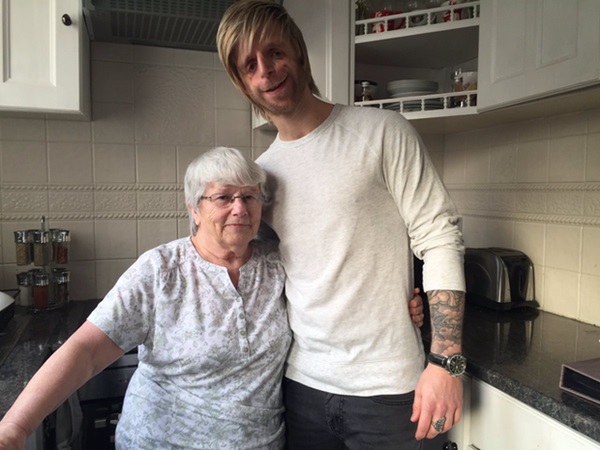 Cậu bé mặt chim” sinh ra mới chưa đầy 2 ngày đã bị bố mẹ bỏ rơi vì quá xấu xí gây bất ngờ với cuộc sống hiện tại bên bạn đời xinh đẹp-6