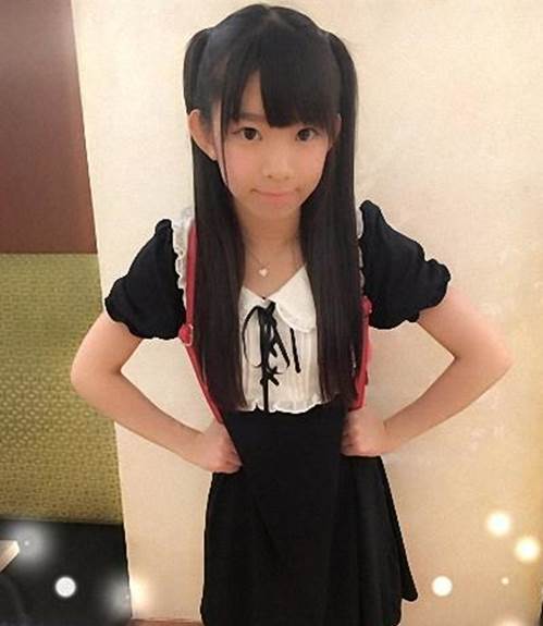 Có nên phẫu thuật thẩm mỹ để cải thiện nhan sắc cho con từ khi còn nhỏ?-2