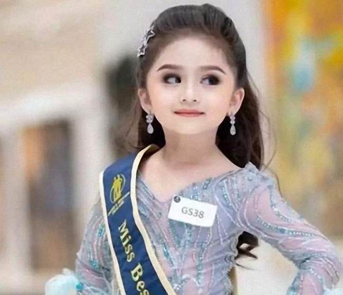 Có nên phẫu thuật thẩm mỹ để cải thiện nhan sắc cho con từ khi còn nhỏ?-4