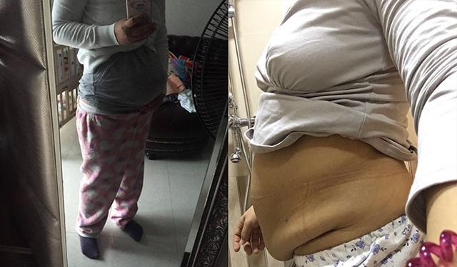 Cô gái 24 tuổi già như bà lão 60 chỉ sau một tháng sinh con, cuộc sống hiện tại của cô sau 17 năm còn bất ngờ hơn nữa!-3