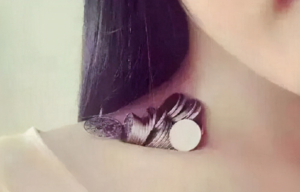 Nữ sinh bị tổn thương thực quản, rối loạn tâm thần chỉ vì bắt chước theo trào lưu của các bạn ở trường học-4