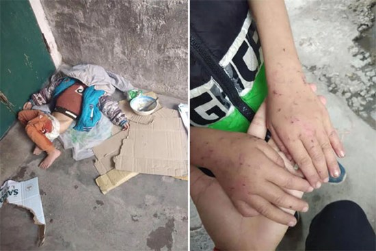Bé trai bị bà ngược đãi thậm tệ, trần truồng giữa trời giá rét với nhiều vết thương trên cơ thể khiến cộng đồng xót xa