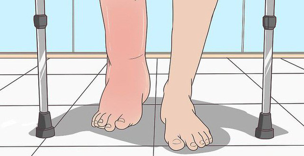 Soi tay chân cũng có thể nhận biết được 5 biểu hiện cảnh báo bạn có nguy cơ mắc ung thư hay không-3