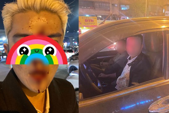 Hà Nội: Xôn xao nam thanh niên bị đánh gãy răng, chảy máu mũi do nhắc nhở tài xế dừng xe quá lâu gây tắc đường